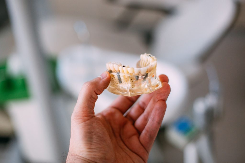 Descalcificación Dental: Causas, Síntomas y Tratamiento