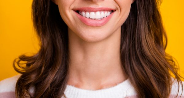 Blanqueamiento dental: todo lo que debes saber