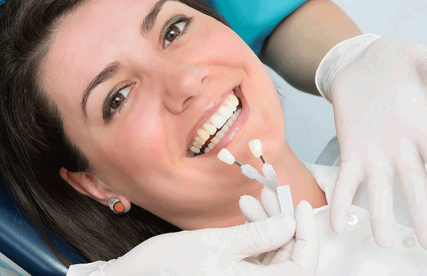 4 Pasos Infalibles para Mantener tus Carillas Dentales