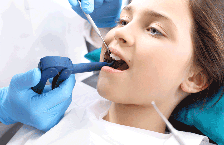 ¿Qué es el sellado dental?