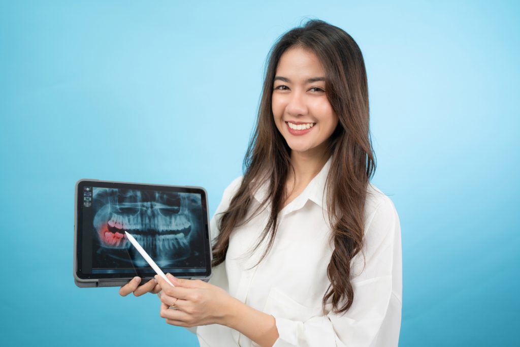 Una radiografía dental puede determinar el éxito de tu tratamiento dental. Conoce todo. 