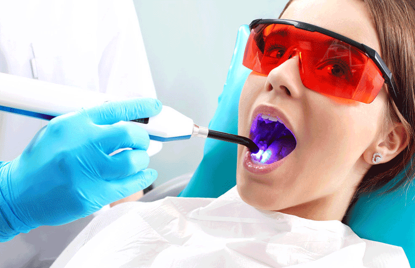 5 Tratamientos Dentales para una Mejor Sonrisa