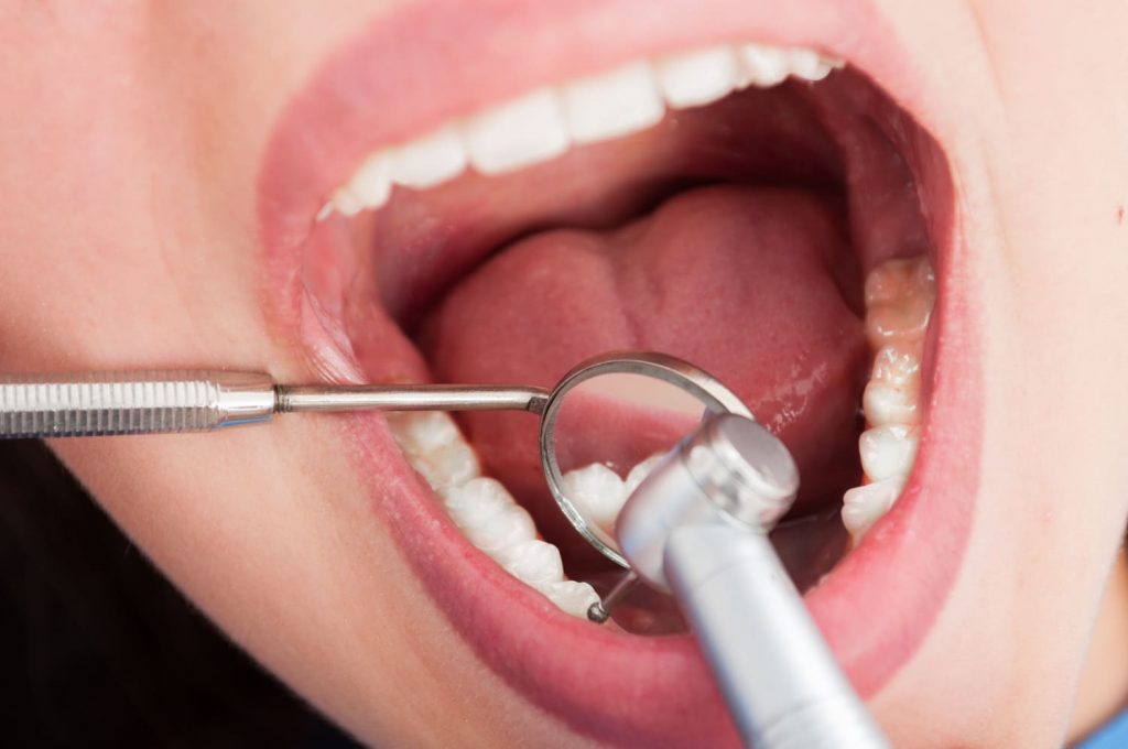 Lo que debes saber de la endodoncia