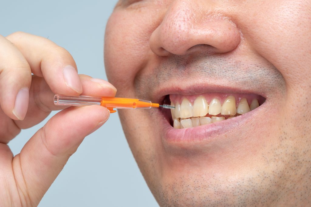 Hombre utilizando cepillo interdental - productos que recomiendan los dentistas