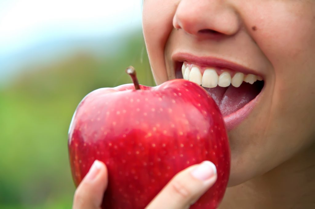 Persona mordiendo una manzana con implantes dentales